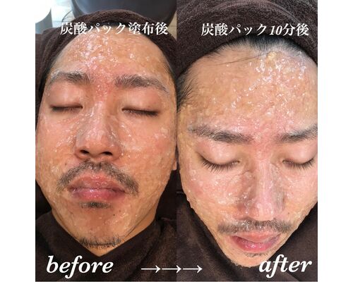 B00AE572-6507-42D5-A9BA-3640976EFFAC